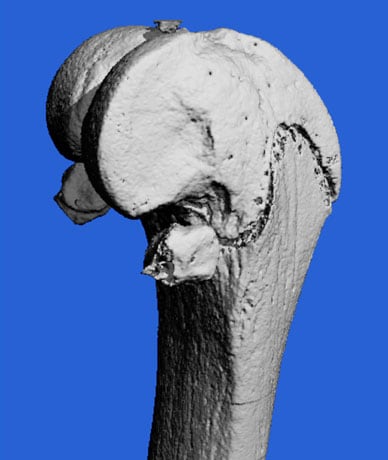 MicroCT scan image of mouse model bone
